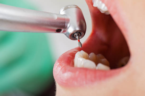 Best Chipped Tooth Repair Near Me  in Albany, OR